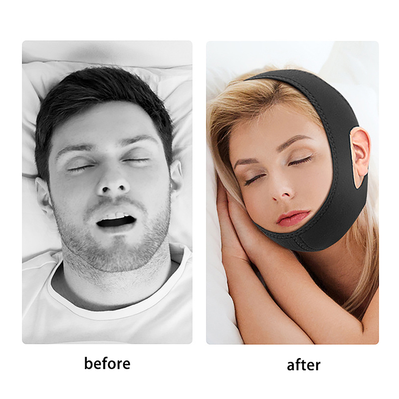 Anti Snore Chin Strap Adjustable - 조절 가능한 새로운 네오프렌 코골이 방지