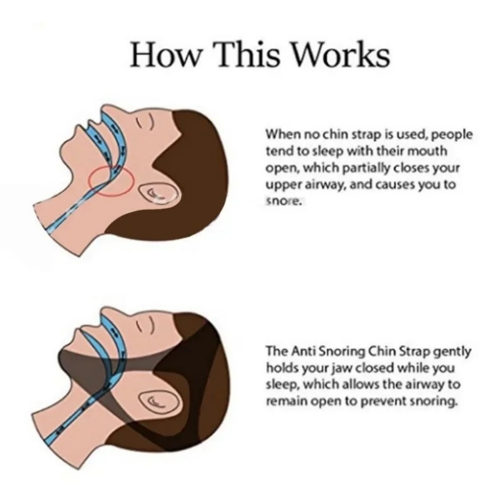 통기성 조절 가능한 코골이 방지 턱 스트랩, 남녀 공용 - Anti Snore Chin Strap Adjustable 리뷰 및 가격